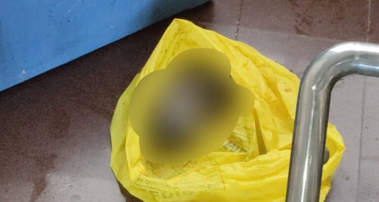 Breaking News : अस्पताल के बाथरूम में मानव भ्रूण मिलने से हड़कंप, जांच से पहले हटाने पर उठे सवाल !